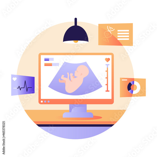 Sonography 