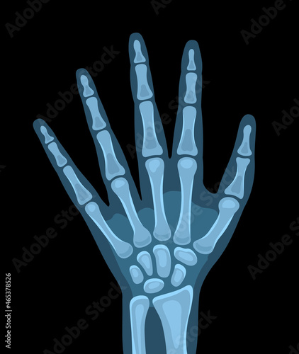 Vector illustration of x-ray picture of the human body, hand. Vector illustration