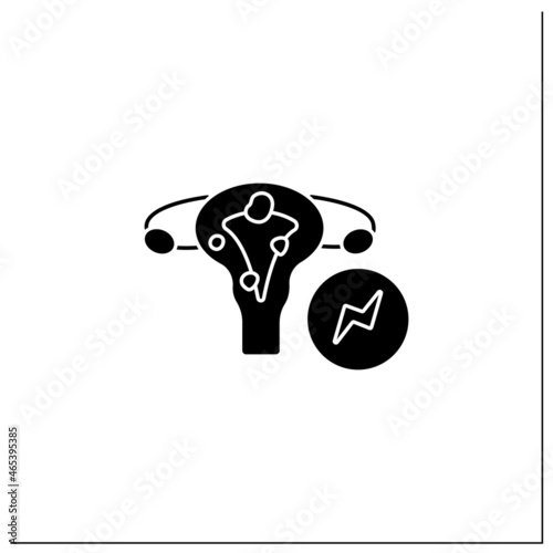 Fibroids glyph icon. Abnormal growth. Develop in the uterus. Cancerous or noncancerous tumors.Health protection. Women health concept.Filled flat sign. Isolated silhouette vector illustration