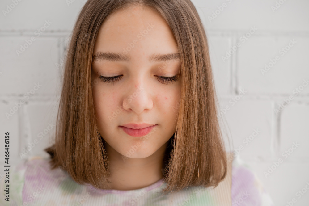 Face of a teenage girl in close up. Teen with problematic skin. Girl with a square hairstyle. Acne and scars. Natural portrait. No makeup and retouch. High quality photo Face of a teenage girl in close up. Teen with problematic skin. Girl with a square hairstyle. Acne and scars. Natural portrait. No makeup and retouch. High quality photo