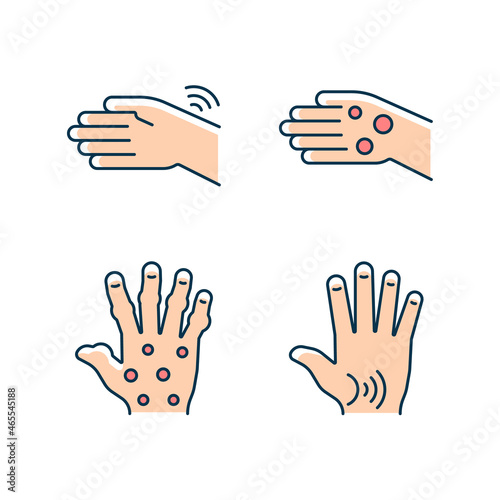 Arthritis in hands RGB color icons set. Wrists rheumatism. Fingers deformity. Rheumatoid nodules. Osteoarthritis in thumb. Isolated vector illustrations. Simple filled line drawings collection