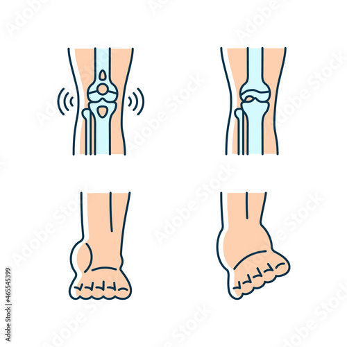 Arthritis leg pain RGB color icons set. Degenerative joint disease. Bursitis condition. Muscles strains. Sprained ankle ligaments. Isolated vector illustrations. Simple filled line drawings collection