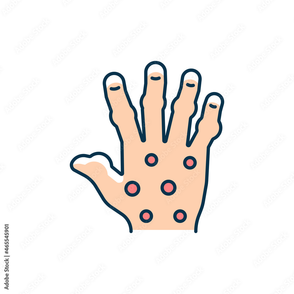 Psoriatic arthritis RGB color icon. Painful finger and hand joints