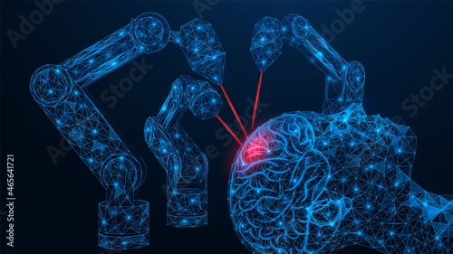 Laser surgery on the human brain. Robotic medical equipment. A low-poly construction of interconnected lines and dots. Blue background.