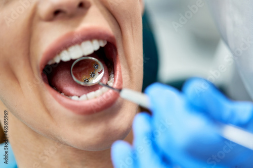 Foto Close-up of woman during inner dental braces check-up at dentist's office