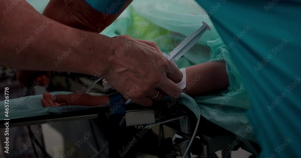 The nurse makes an intravenous infusion, preparing for the operation. Close-up of a hand with a catheter. Pediatric surgery. The nurse makes an intravenous infusion, preparing for the operation. Close-up of a hand with a catheter. Pediatric surgery.