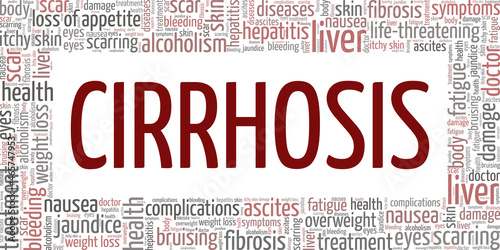 Liver Cirrhosis vector illustration word cloud isolated on white background.