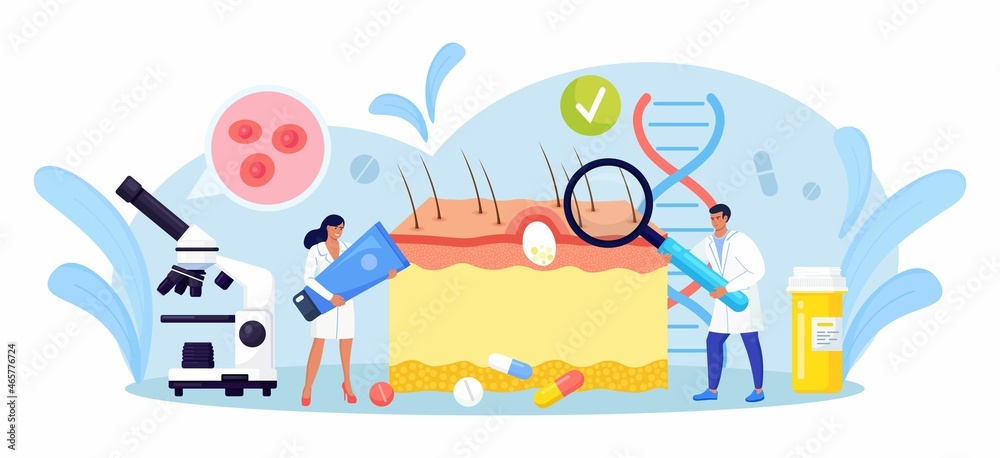 Obraz premium Dermatology. Skin Epidermis Scheme with Acne Inflammation, Varicella, Allergies or Cancer. Doctors with Medical Equipment Examining Red Spots, Pimples. Dermatologist Diagnosis Skin Disease. Vector