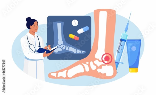 Ankle Foot arthritis. Doctor examining xray pictures of joints. Osteoarthritis, rheumatoid arthritis, rheumatism disease. Physician treat patient joint pain. Vector illustration