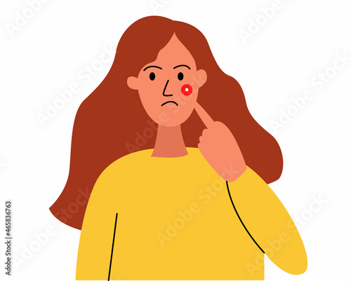 The girl shows a pimple on her face, problem skin, acne. Vector illustration