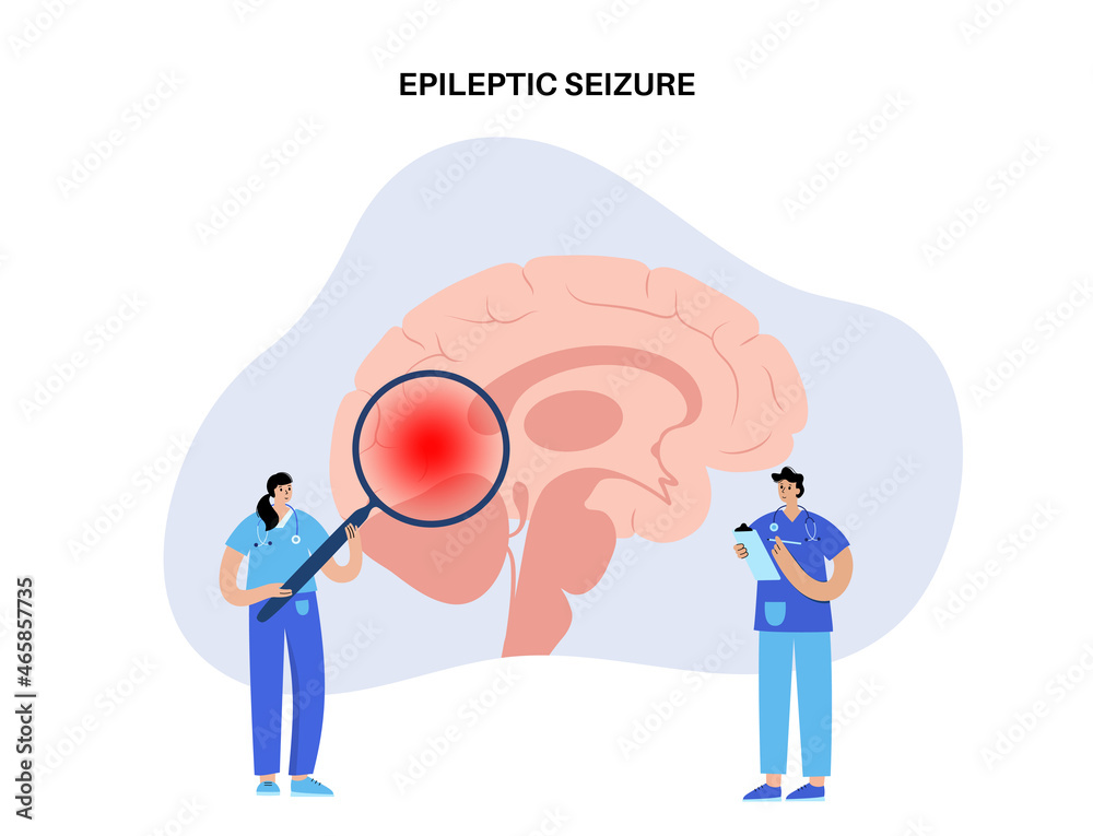 epilepsy seizure concept epilepsy seizure concept