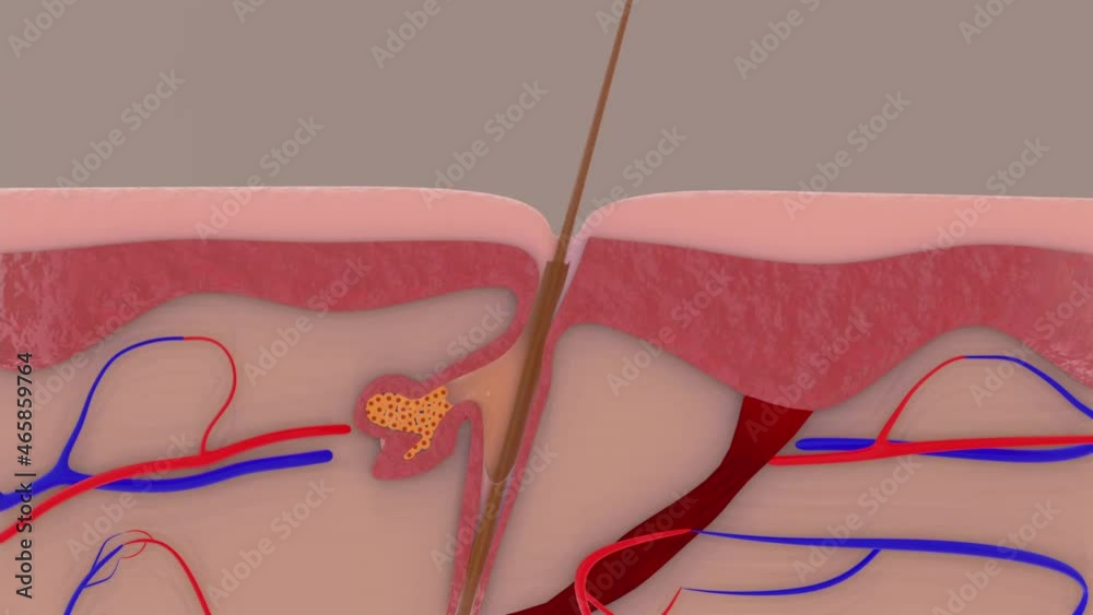 Acne Animation Stock Video Adobe Stock Acne Animation Stock Video Adobe Stock
