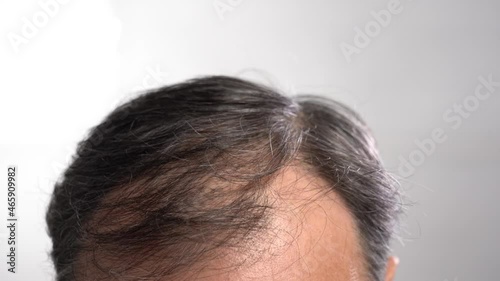 Balding male head close-up on light gray background photo