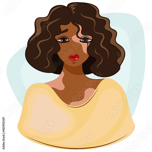 Abstract portrait of an unhappy African American girl with vitiligo disease. Vector concept to support people suffering from vitiligo, skin disease awareness. Take care of yourself and your loved ones