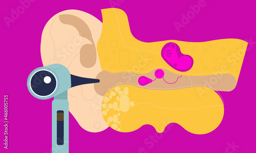 Otolaryngology concept. Cartoon ear anatomy. Flat vector illustration use in project.