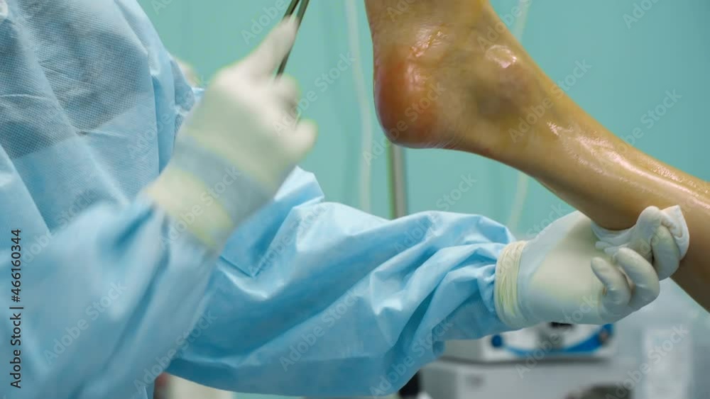 the surgeon treats the patient's leg before the operation the surgeon treats the patient's leg before the operation