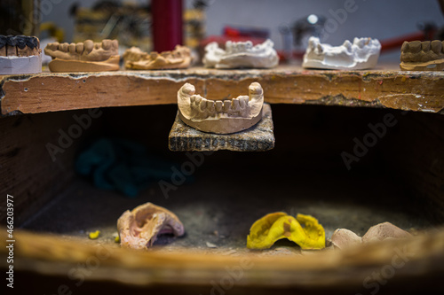 a copy of a human tooth with a dental technician