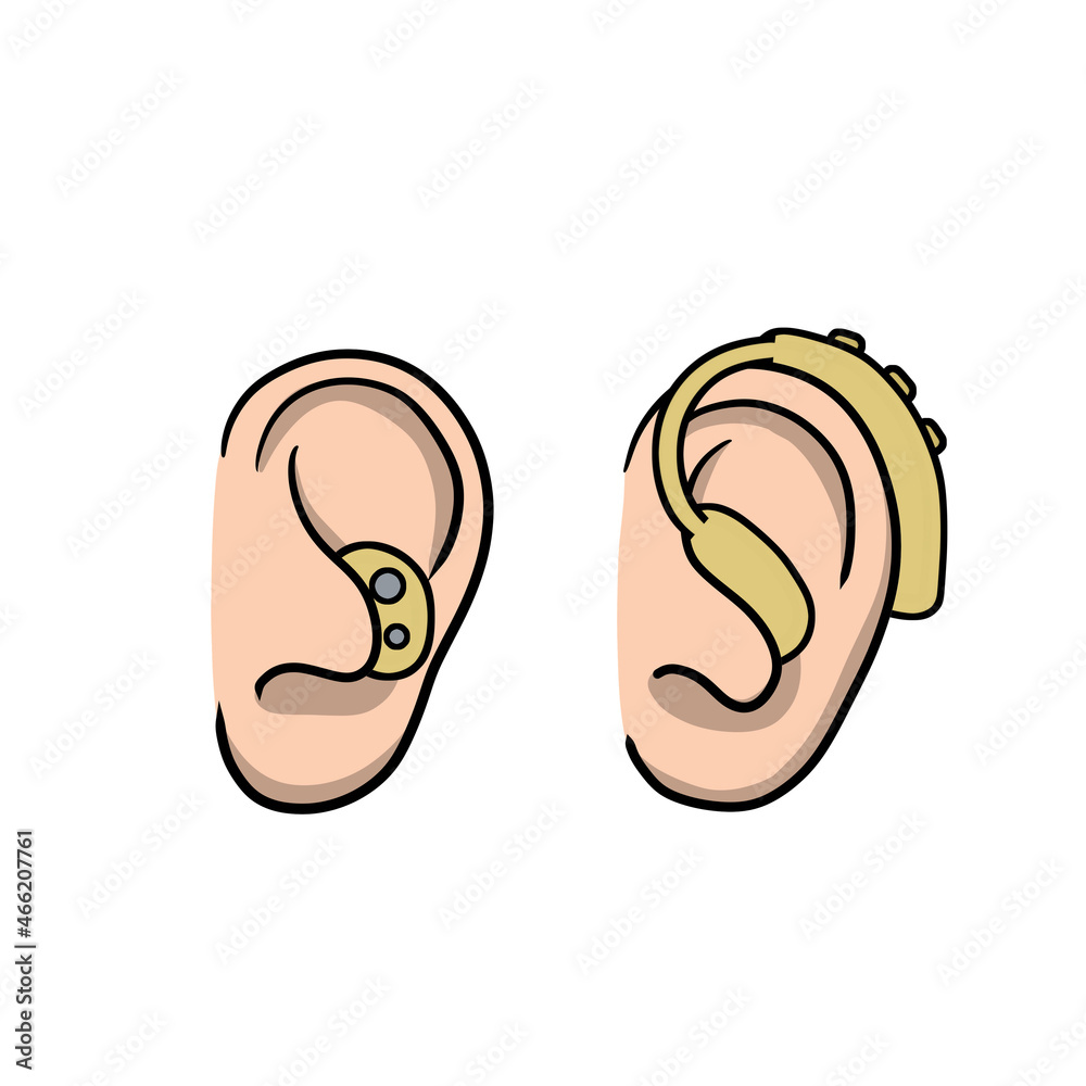 Hearing aid. Audiphone in ear. Hearing problems and disabilities. Set of Cartoon illustration Hearing aid. Audiphone in ear. Hearing problems and disabilities. Set of Cartoon illustration