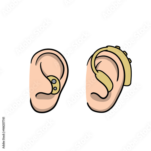 Hearing aid. Audiphone in ear. Hearing problems and disabilities. Set of Cartoon illustration