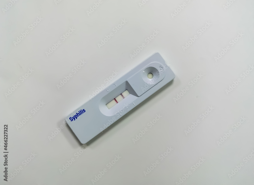 Close view of the device of Syphilis testing show positive result of a patient. rapid screening test. VDRL. TPHA. Close view of the device of Syphilis testing show positive result of a patient. rapid screening test. VDRL. TPHA.