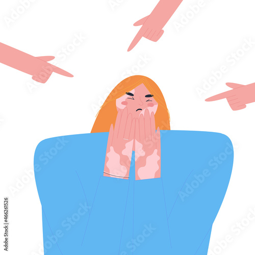 A sad and frightened young woman surrounded by hands with index fingers pointed at her. Victim of accusation and public censure. Flat Vector.