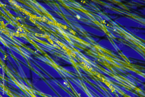 Microscopic view of a cyanobacteria (blue-green algae, Oscillatoria) filaments. Polarized light with crossed polarizers.