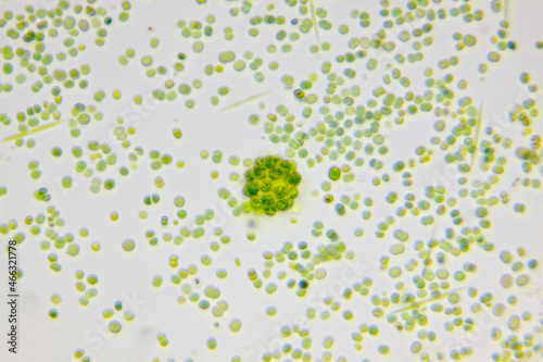 Microscopic view of colonial green algae Coelastrum between single-cell algae. Brightfield illumination.