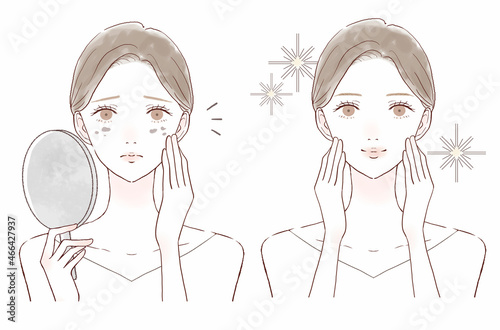 シミに悩む女性のビフォーアフター