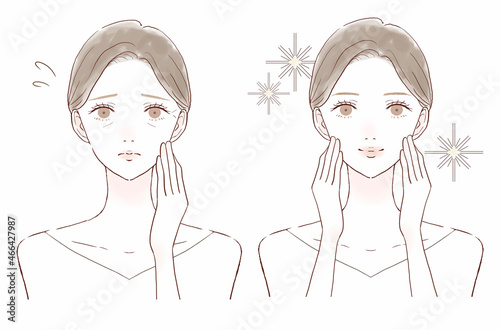 小じわに悩む女性のビフォーアフター