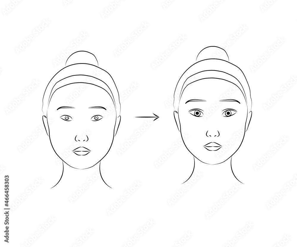 Plastic surgery on a woman's face. Silhouette V - line of the face. Vector illustration. Plastic surgery on a woman's face. Silhouette V - line of the face. Vector illustration.