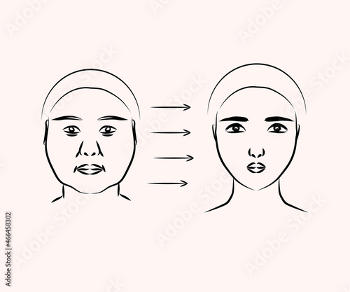 Plastic surgery on a woman's face. Silhouette V - line of the face. Vector illustration. 