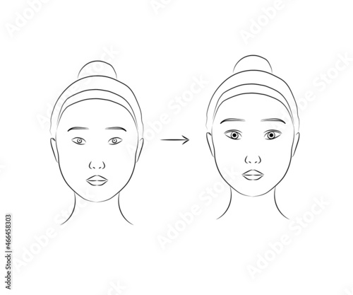 Plastic surgery on a woman's face. Silhouette V - line of the face. Vector illustration. 