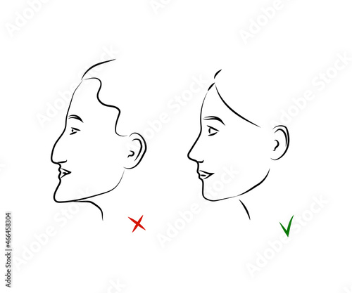 Plastic surgery on a woman's face. Silhouette V - line of the face. Vector illustration.