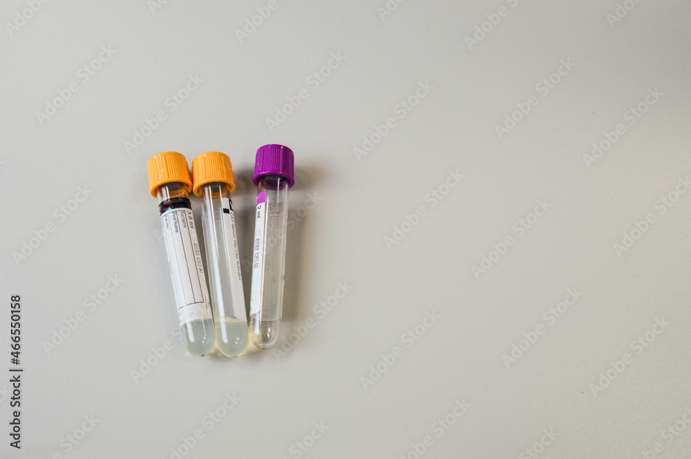 Laboratory Test Tubes in Science Research Lab Laboratory Test Tubes in Science Research Lab