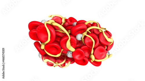 Thrombosis, platelets and fibrin formatting a blood clot with white blood cells, 3d illustration photo