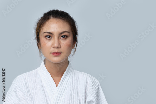 Portrait of beautiful Asian woman in White Waffle weave Bathrobe with Dark spots, Face scars, Dead skin cells on face. Effect from coronavirus protective gear N95 mask for healthcare worker photo