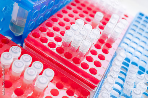 Pack of test tubes in medical laboratory