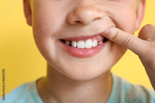 Little boy with healthy gums on yellow background  closeup