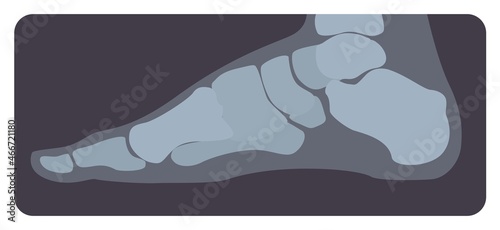Lateral radiograph of human foot or limb. X-ray picture or radiographic image of metatarsus bones and toes, side view. Modern medical radiography. Monochrome vector illustration in flat cartoon style