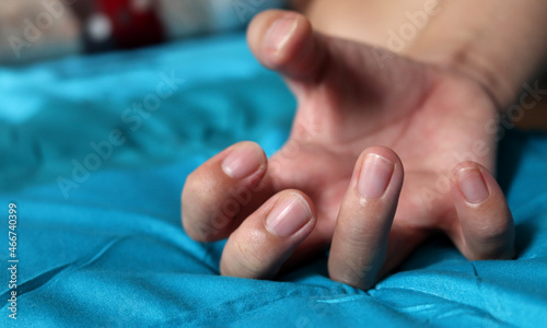 Woman hand spasticity and Hypermobile fingers photo