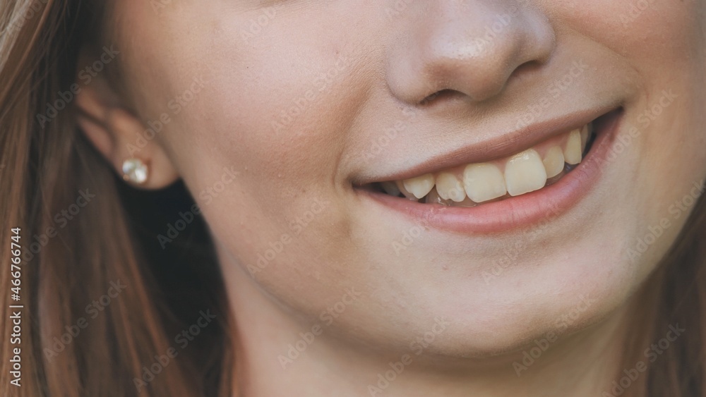 A young girl smiles and shows her crooked teeth. A young girl smiles and shows her crooked teeth.