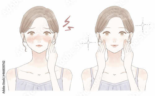 肌の炎症に悩む女性のビフォーアフター