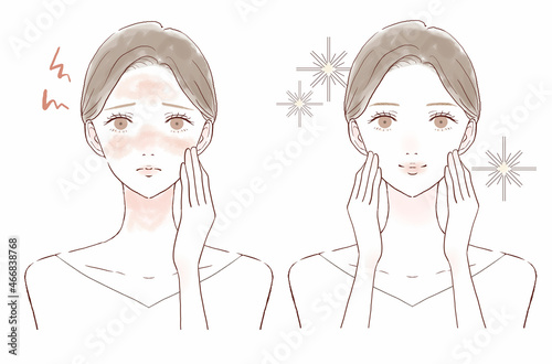 肌の炎症に悩む女性のビフォーアフター