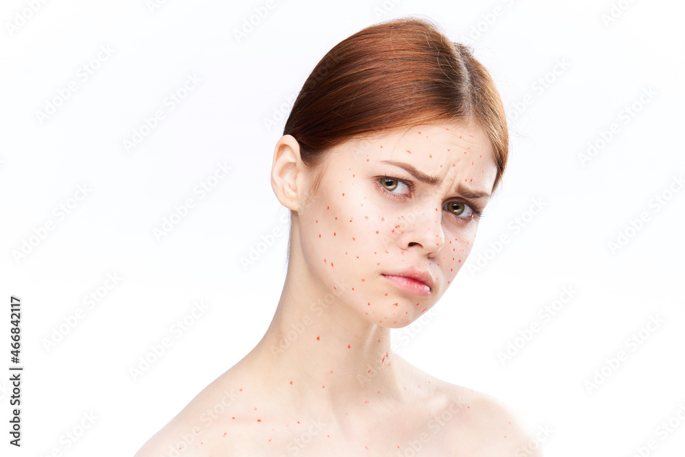 sad woman with bare shoulders red dots on her face sad woman with bare shoulders red dots on her face