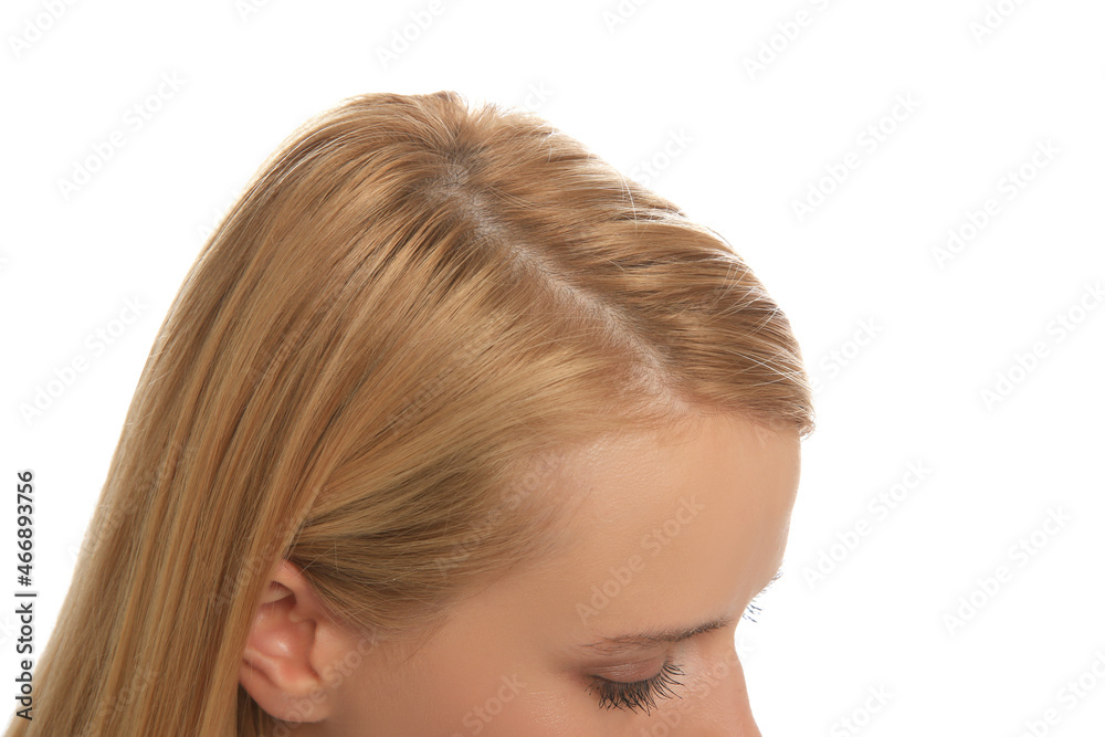 Woman with hair loss problem on white background, closeup. Trichology treatment Woman with hair loss problem on white background, closeup. Trichology treatment