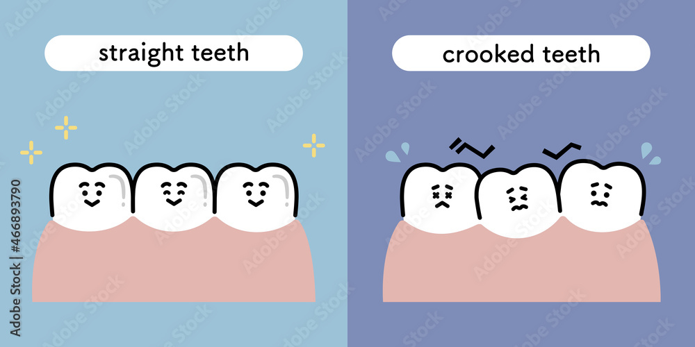 歯並びの良い歯 悪い歯 対比 イラストセット Stock ベクター Adobe Stock 歯並びの良い歯 悪い歯 対比 イラストセット Stock ベクター Adobe Stock