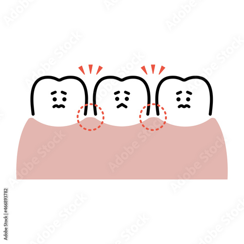 すきっ歯（キャラクター）