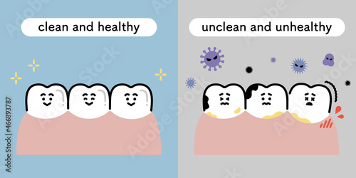 健康な歯と虫歯　対比　イラストセット