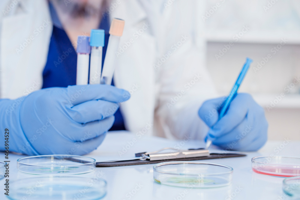 Mockup copy space blank label of medical blood sample vials bottles in doctor's hand wearing face mask and gloves. Hand holding blood sample vials with tests results. Doctor writing Mockup copy space blank label of medical blood sample vials bottles in doctor's hand wearing face mask and gloves. Hand holding blood sample vials with tests results. Doctor writing