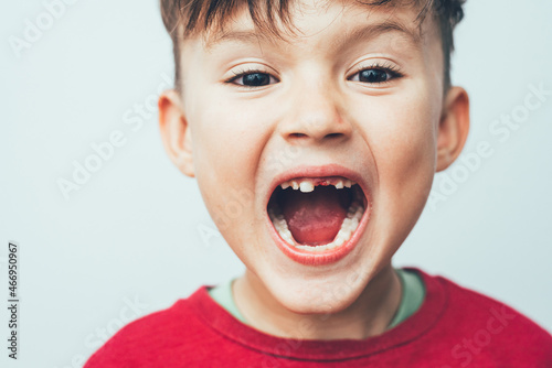 Portrait of a child with an open mouth a tooth fell out